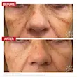 قطره ضد لک و روشن‌کننده دکتر لوی | Dr. Levy Pigment Control Drops