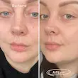 روغن رز هیپ ضد چروک و روشن کننده پای | Pai Rosehip BioRegenerate Face Oil 30ml