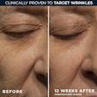 کرم شب ضد چروک رتینول راک | RoC RETINOL CORREXION® Deep Wrinkle Night Cream