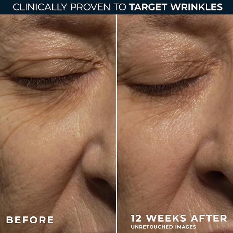 کرم شب ضد چروک رتینول روک | RoC RETINOL CORREXION® Deep Wrinkle Night Cream