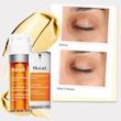 سرم دور چشم مورد | Murad Environmental Shield Vita-C Eyes Dark Circle Corrector