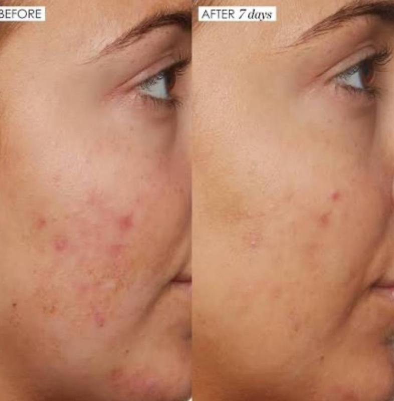 سرم نیاسینامید ساندی رایلی | Sunday Riley B3 Nice 10% Niacinamide Serum