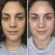 سرم لایه‌بردار لیكوئيد گلد آلفا اچ | Alpha-H Liquid Gold Exfoliating Treatment 5% Glycolic Acid