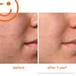 اسکراب و لایه‌بردار حرفه‌ای کیت سامرویل | Kate Somerville ExfoliKate Intensive Exfoliating Treatment