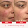 کرم مرطوب‌کننده و ترمیم کننده فرست اید بیوتی | First Aid Beauty Ultra Repair Cream Intense Hydration