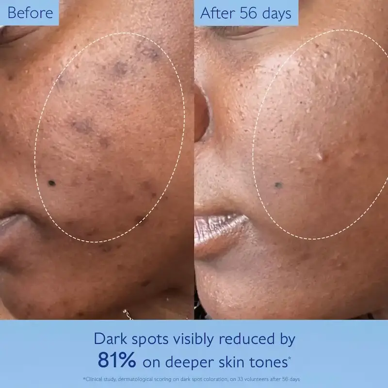 سرم روشن‌کننده و اصلاح‌کننده لک کدلی | Caudalie Vinoperfect Complexion Correcting Radiance Serum