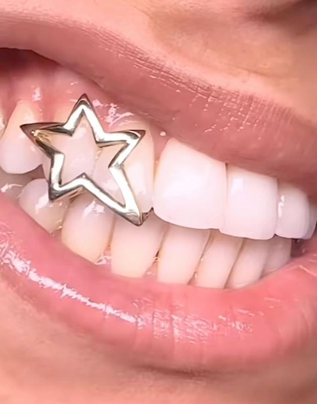 گریلز دندان