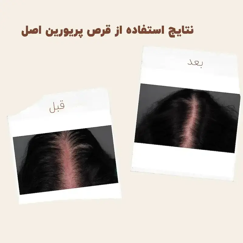 کپسول پریورین بایر ضدریزش هورمونی و ارثی آلمانی
