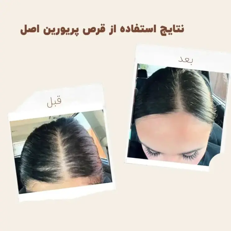 کپسول پریورین بایر ضدریزش هورمونی و ارثی آلمانی