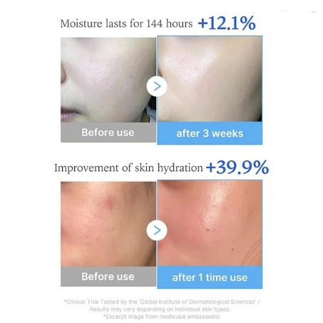 سرم آبرسان هیالورونیک اسید و مولتی پپتاید مدی کیوب حجم 30 میل MEDICUBE HYALURONIC MULTIPEPTIDE SERUM 30 ML