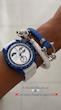 ساعت امگا سواچ مون شاین دورنگ سفید کاربنی Omega Swatch to the Moonshine 