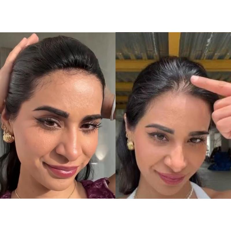 مو پروتز دو گیره هیدن با دوخت مخفی