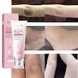 کرم صورتی کننده نقاط حساس بدن سادور 30 میل SADOER Delicate Pink Dew
