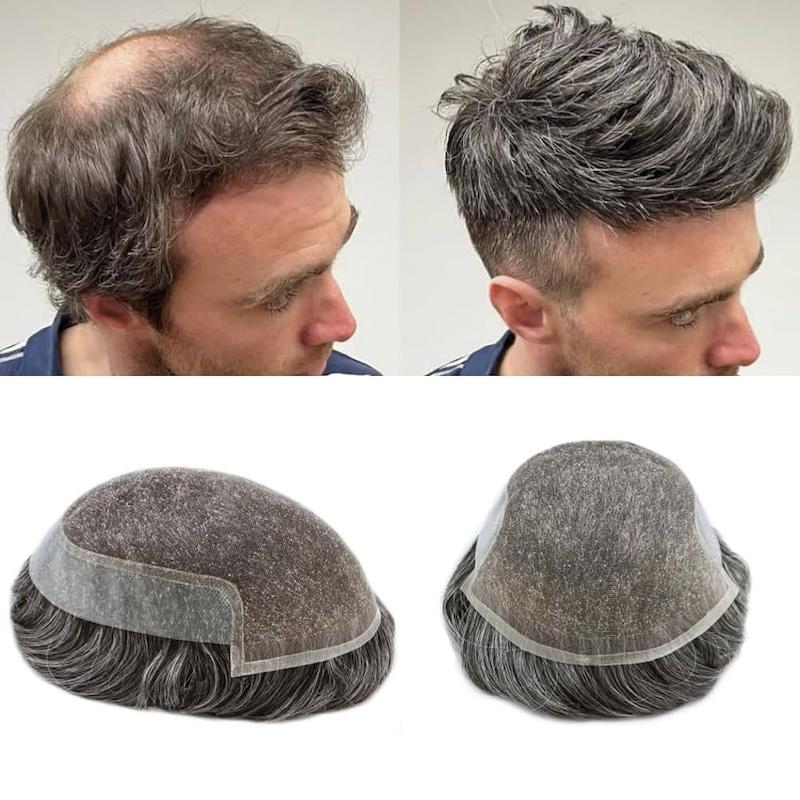 پروتز مو مردانه 20% جوگندمی جنس مو طبیعی با خط رویش پوستی