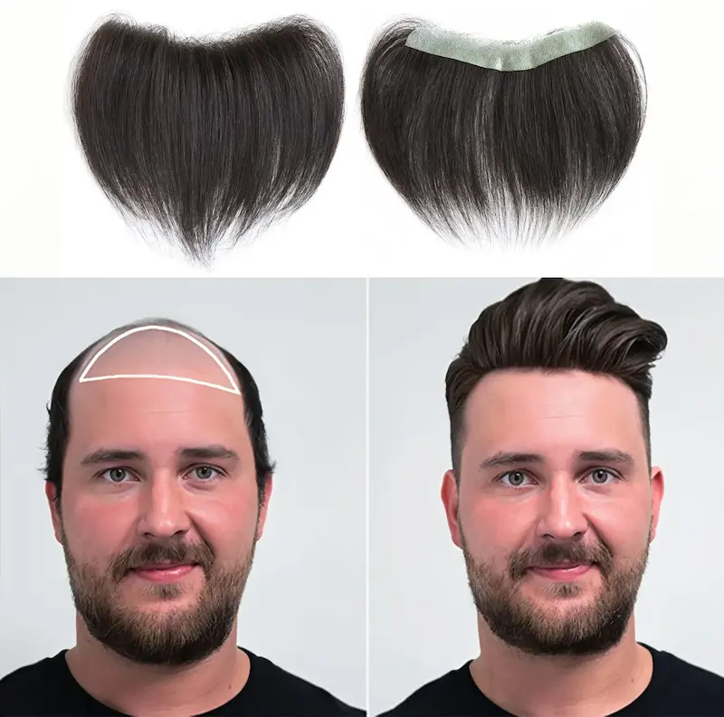 پروتز مردانه مشکی طبیعی مدل جلوسر خط رویش طبیعی 