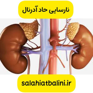 مدیریت بیمار با نارسایی حاد آدرنال در اورژانس از سری سوالات احتمالی آزمون صلاحیت بالینی