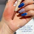 سایه استیکی 