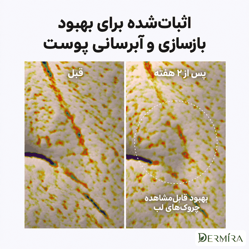بوستر شات NAD+ آرنسیا (2)