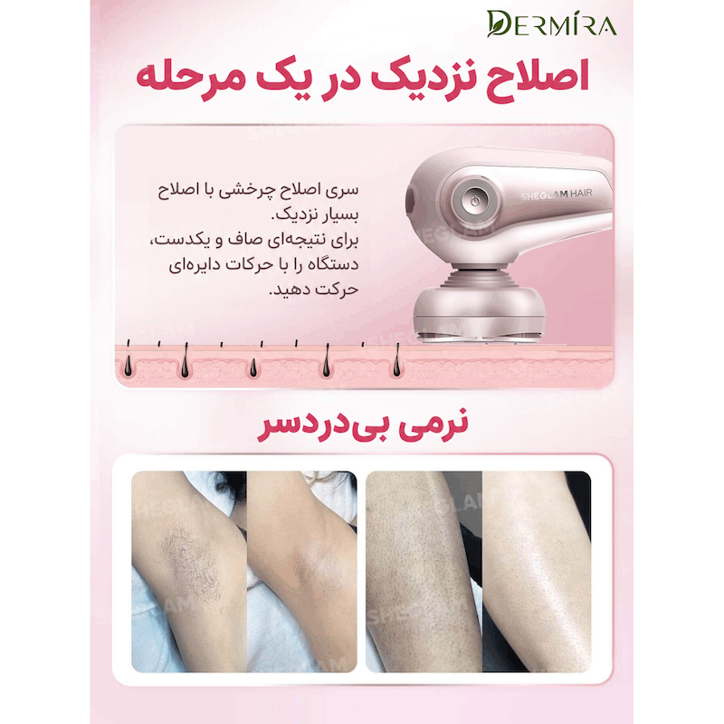 اینفوگرافیک نمایش نتیجه اصلاح با شیور ۵ تیغه شیگلم