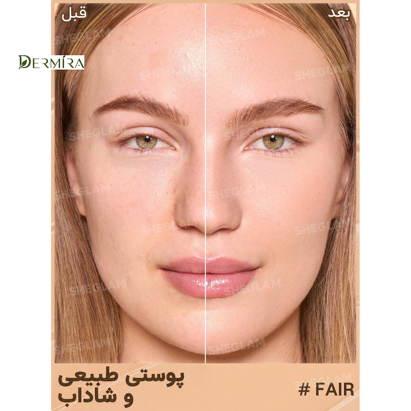 کرم‌پودر تینت شیگلم - SPF20