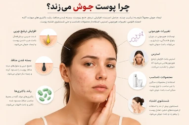 درمان جوش، جای جوش و لک | بهترین روتین پوستی و اشتباهاتی که باعث جوش می‌شوند