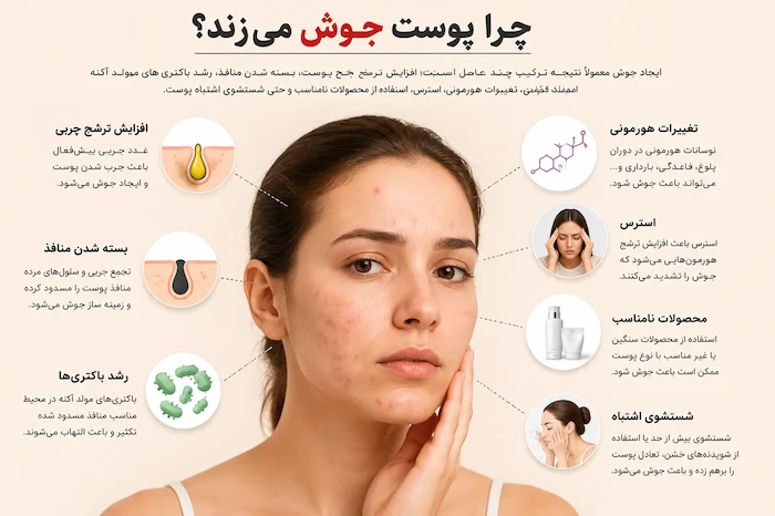 درمان جوش، جای جوش و لک | بهترین روتین پوستی و اشتباهاتی که باعث جوش می‌شوند
