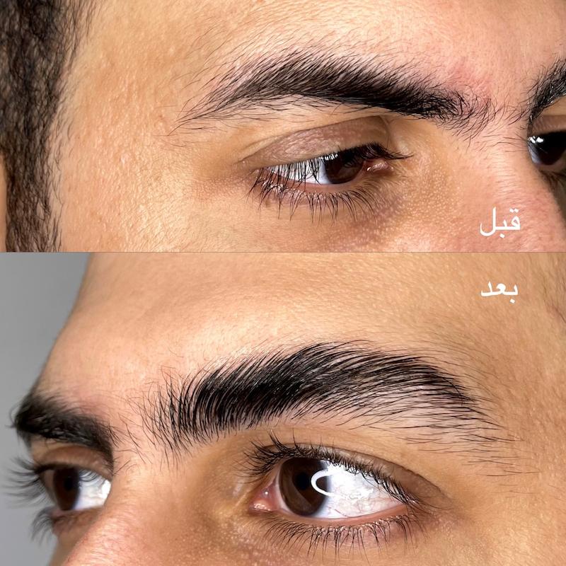 ژل لیفت ابرو هرموسا