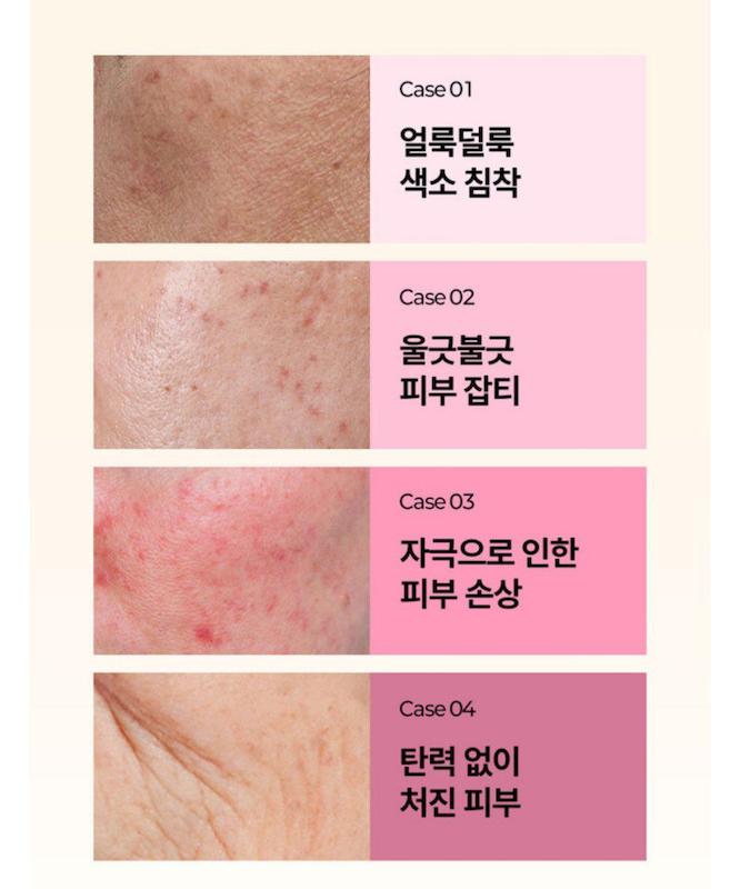 صابون سفیدکننده گلوتاتیون Gongskin