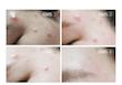 کرم ترمیم کننده ساشه ای CSLAB اورجینال
