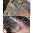 سرم ضد ریزش و حجم دهنده موی مولتی پپتید اوردینری The Ordinary