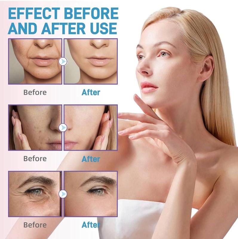 ویال شفاف کننده هیالورونیک اسید 7 روزه