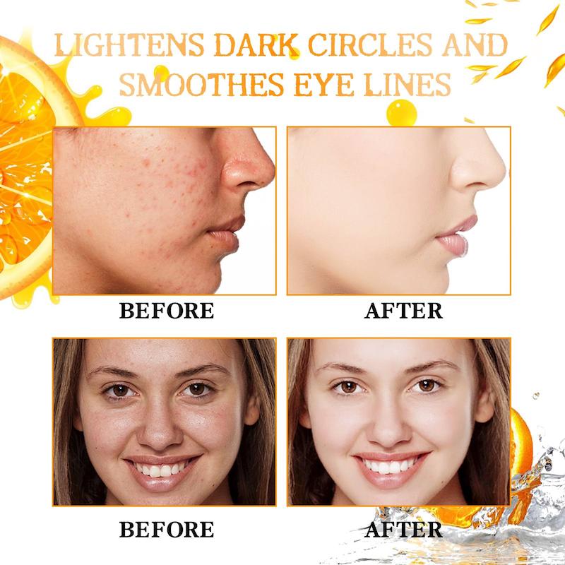 ویال روشن کننده و رفع جای جوش Vitamin c
