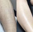 شوگر اسکراب میوه ای رفع پوست مرغی و موی زیر پوستی