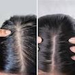 اسکراب کف سر پاکسازی چربی و شوره |ضد ریزش و تقویت‌کننده|