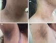 سرم روشن کننده و ضد لک کوجیک اسید دکتر مینایر (Dr. Meinaier) - ۱۲۰ میل