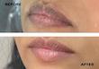 سرم روشن کننده و ضد لک کوجیک اسید دکتر مینایر (Dr. Meinaier) - ۱۲۰ میل