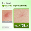 Anua Azelaic Acid 10 Hyaluron Redness Soothing Serum سرم ضد لک آنوا مدل Azelaic Acid