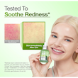 Anua Azelaic Acid 10 Hyaluron Redness Soothing Serum سرم ضد لک آنوا مدل Azelaic Acid
