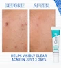 ژل ضدجوش سراوی 40ml امریکایی