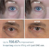  دور چشم ضد پف و تیرگی دکتر ملاکسین مدل Eyephalt
