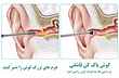 ست گوش پاک کن 6 تکه فانتزی