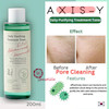 تونر ضد جوش اکسیس وای | Axis-Y Daily Purifying Treatment Toner