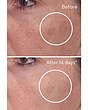 سرم برطرف کننده لک سریع مورد -rapid correcting dark spot murad