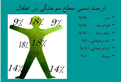 پاورپوینت سوختگی و اقدامات پرستاری