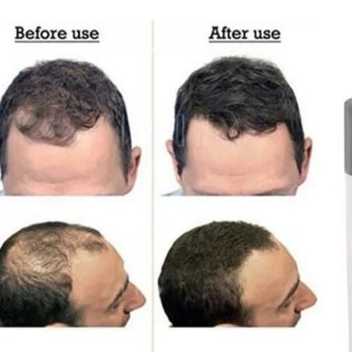 پودر پرپشت کننده Primer