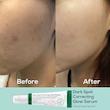 سرم ضد لک اکسیس وای AXIS-Y مدل Dark Spot Correcting Glow Serum 