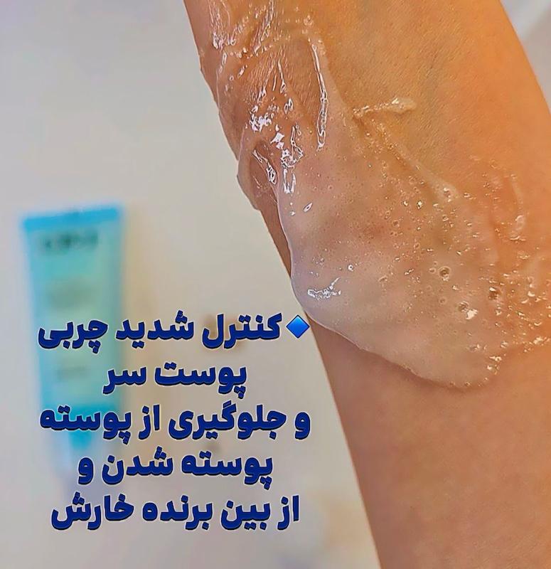 لایه‌بردار تخصصی پوست سر اِستِتیک هاوس