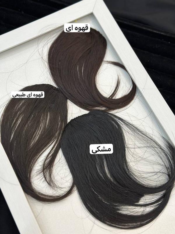 پروتز چتری
