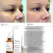 سرم دور چشم کافئین اوردینری Ordinary مدل Caffeine Solution 5% + Egcg حجم 30ml خریداری شده از سفورا دبی
