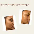 تونر لایه بردار و روشن کننده گلیکولیک اسید اوردینری | The Ordinary Glycolic Acid 7% Toning Solution خریداری شده از سفورا دبی
